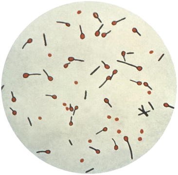 Vi khuẩn Clostridium spp
