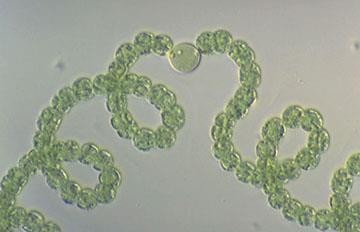Anabaena oumiana