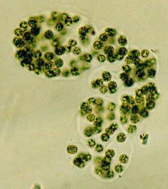 Microcystis aeruginosa