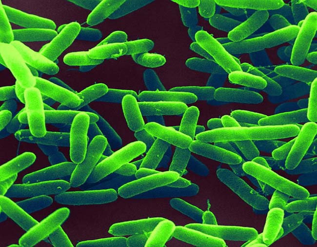 Vi khuẩn Pseudomonas có cấu trúc dạng hình que, tồn tại ở khắp mọi nơi, hoạt động mạnh mẽ trong nhiều điều kiện môi trường.