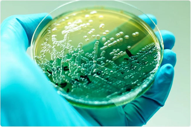 Vi khuẩn Pseudomonas thích nghi và hoạt động tốt trong nhiều môi trường, có khả năng lội tốt trong nước.