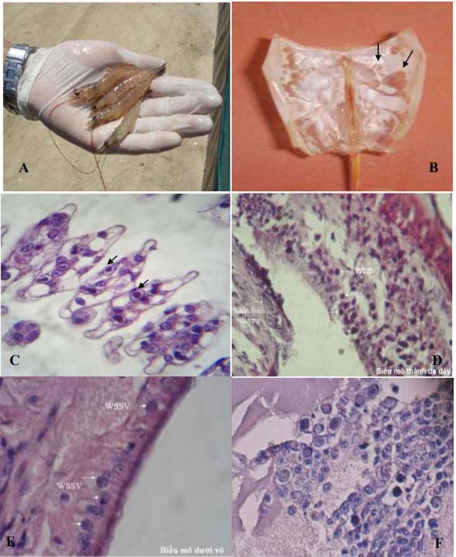 Tôm chân trắng bị cảm nhiễm virus WSSV thể hiện dấu hiệu bệnh lý đỏ thân(A); xuất hiện các đốm trắng trên giáp đầu ngực (B); tiêu bản mô bệnh học phát hiện các thể vùi dạng Cowdry type A ở mô mang, đặc trưng cho giai đoạn sớm của cảm nhiễm, thể vùi chưa chiếm hết thể tích của nhân và nhuộm màu hồng của eosin do tính ưa acid (C); giai đoạn muộn các thể vùi phì đại chiếm hết thể tích của nhân và nhuộm màu tím hồng do tính ưa kiềm, được phát hiện ở biểu mô thành dạ dày (D); biểu mô dưới vỏ (E); cơ quan tạo máu (F).