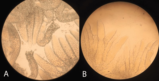 Mẫu gan tôm khỏe (A), và mẫu gan tôm nhiễm EHP (B).