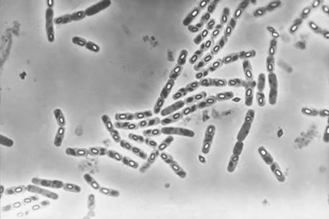 Vi khuẩn Bacillus thuringiensis israelensis (khi soi dưới kính hiển vi).