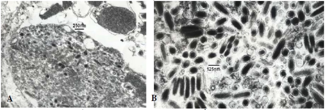 Virus gây bệnh đốm trắng trên tôm.