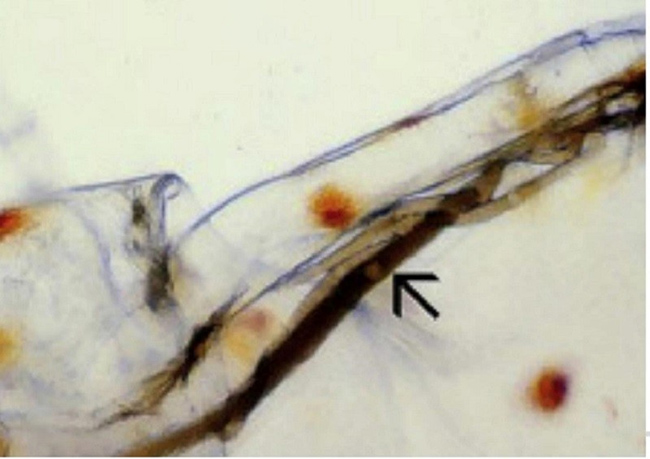 Ký sinh trùng Gregarine gây bệnh trên tôm.