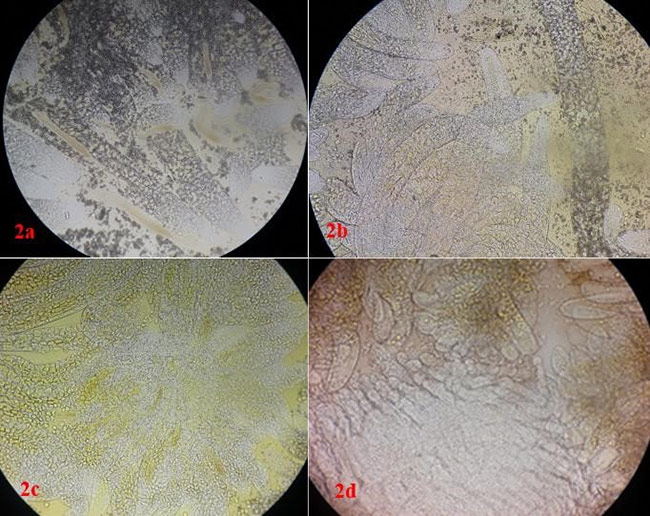 Ký sinh trùng Vermiform trên tôm.