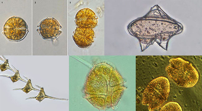 Tảo giáp – một loại tảo độc trong ao tôm – dưới kính hiển vi.