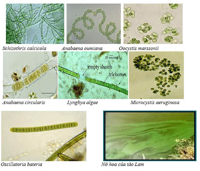 Tảo lam, một trong các loại tảo độc trong ao tôm qua kính hiển vi.