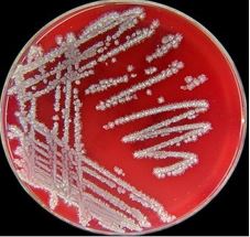 Thống kê các chủng vi sinh vật xử lý nước thải và chức năng của chúng Thống kê các chủng vi sinh vật xử lý nước thải và chức năng của chúng
