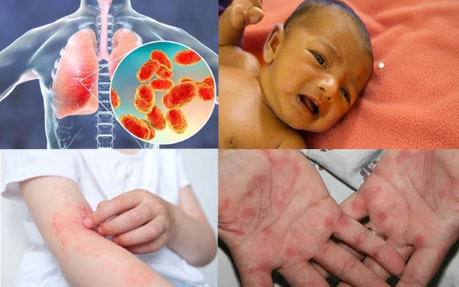 Amoni đặc biệt nguy hiểm cho trẻ sơ sinh dưới 6 tháng tuổi. Amoni đặc biệt nguy hiểm cho trẻ sơ sinh dưới 6 tháng tuổi.