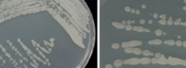 Bacillus Amyloliquefaciens là một trong 4 chủng vi sinh có lợi cho đường ruột tôm. Bacillus Amyloliquefaciens là một trong 4 chủng vi sinh có lợi cho đường ruột tôm.