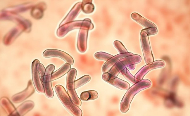 Vi khuẩn Vibrio là nguyên nhân gây hội chứng tôm chết sớm (EMS) ở tôm. Vi khuẩn Vibrio là nguyên nhân gây hội chứng tôm chết sớm (EMS) ở tôm.