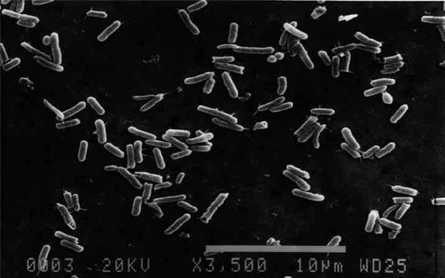 Vi khuẩn Wolinella succinogenes dưới kính hiển vi. Vi khuẩn Wolinella succinogenes dưới kính hiển vi.